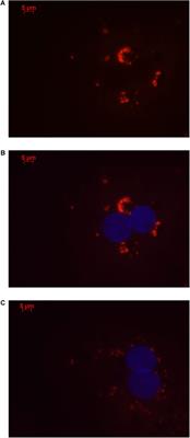 A Long Non-coding RNA, LOC157273, Is an Effector Transcript at the Chromosome 8p23.1-PPP1R3B Metabolic Traits and Type 2 Diabetes Risk Locus